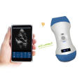 Medical Equipment Wireless Color Doppler Ultrasound Scanner WiFi Probe Convex Linear Handheld Ultrasound